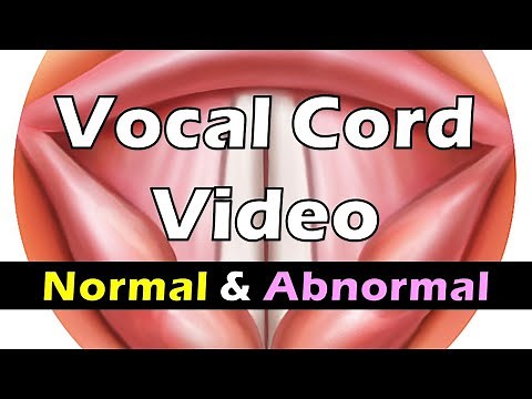 Vocal Cord Movement (Normal vs Abnormal)