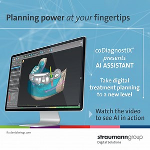 The new coDiagnostiX software release now includes AI-powered technology to streamline treatment workflow. The AI Assistant helps to automate segmentation so you can plan with confidence. Watch the video to see AI in action at https://bit.ly/3UOdSNS | Neodent
