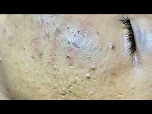 Satisfying video with Chung Vo Spa | 342
