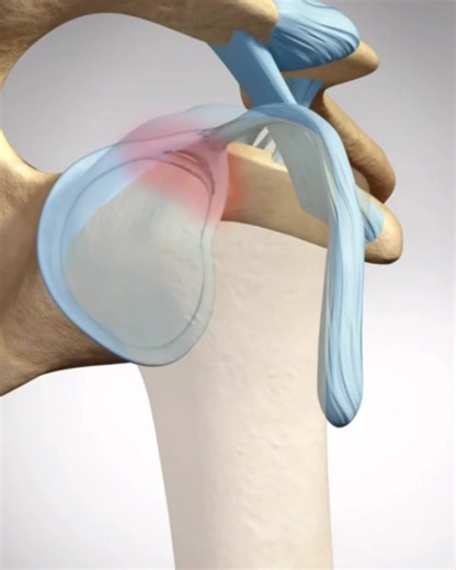 4.7K views · 53 reactions | Jarome Luai underwent a latarjet shoulder...