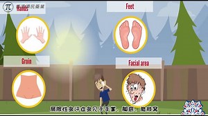 患者在使用索吡溴铵Sofdra治疗原发性腋窝多汗症的时候应该注意什么 有哪些不良反应？