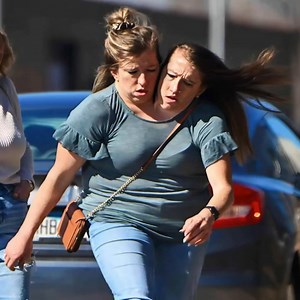 The world has been captivated as the most unusual conjoined twins...