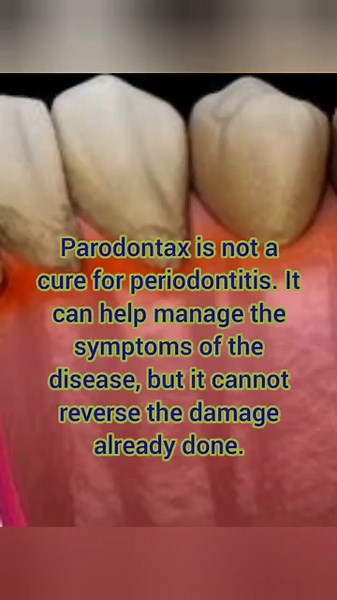 What are the benefits of parodontax?#parodontax#gingivitis#periodontitis#toothpaste