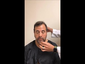 Using chest and beard hair as donor hair for hair transplant