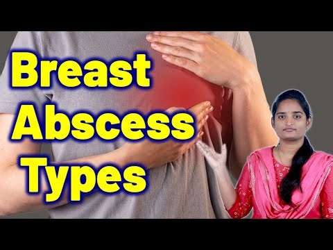 Breast Abscess Types | Infected Breast Lump Homeopathy Treatment Cure Medicine | Gynaecology Women