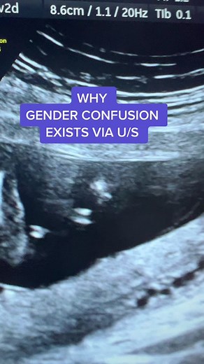 Gender Confusion in Ultrasound - Explained by an Expert