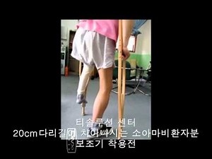 poliomyelitis polio brace