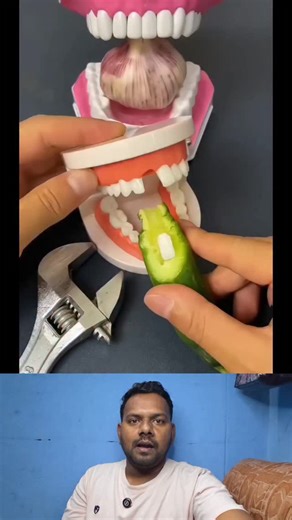 Sathish R on Instagram: "Temporary Tooth Replacement Kit Simple Dental Repair at Home Teeth Whitening Liquid"