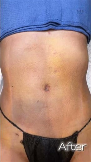 Awake. Sculpted. Snatched. ✨