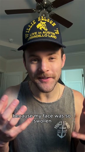 HAE advocate Ben shares what it’s like living with a rare disease.