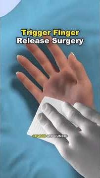 Trigger Finger Release Surgery (3D Animation) #triggerfinger #triggerfingerrelease #triggerfinger