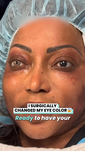 77K views · 161 reactions | If you can change hair color, why not change eye color  | Ultimate | Facebook