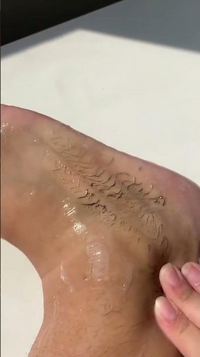 ​Stop Using Harsh Scrubs! Try This Dead Skin Remover Gel (Instant Results