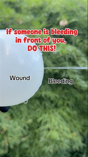 How To Stop A Bleeding Wound