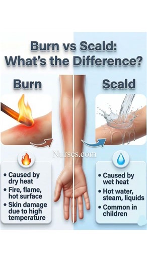 What is the difference between Burns and Scald?#nurse #nursingstudent #nursing #nurses #viralvideo
