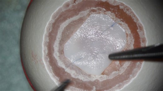 Someone get this egg to a surgeon!