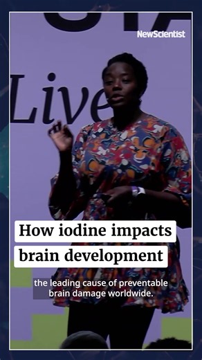 Iodine's Huge Impact on the Brain: Expert Insights from Kimberley Wilson
