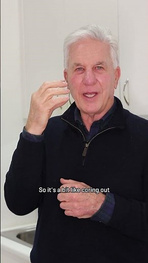 How Fraxel Laser works? By Doctor Garry Cussell | Best Skin Rejuvenation and Repair
