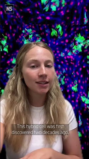 New type of brain cell discovered