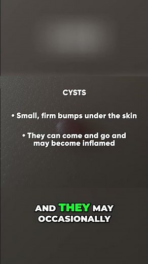 Understanding Skin Cysts: Causes, Symptoms, and Safety #shorts