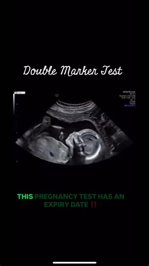 The Double Marker is the only test in pregnancy with a strict “expiry date.” You must get it done between Week 11 and 13.6—not a day later. After this window, the fluid behind the baby’s neck (NT) is absorbed and your blood markers shift, making it impossible to get an accurate screening for chromosomal health. Don’t wait for your next routine checkup to book this. It’s a critical “early warning system” that gives you and your doctor essential answers about your baby’s DNA. Check your calendar, 