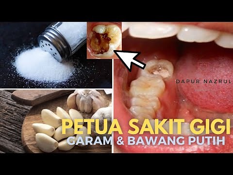 PETUA SAKIT GIGI | SAKIT GIGI BERLUBANG | UBAT SAKIT GIGI | UBAT SAKIT GIGI BERLUBANG