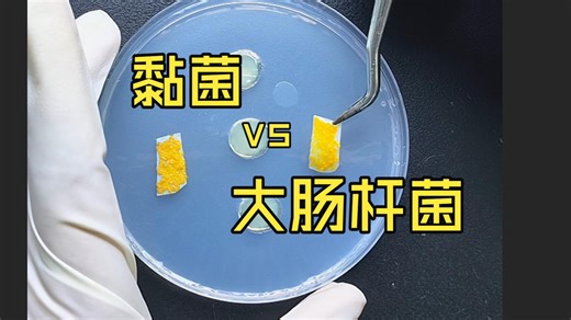 黏菌能吃掉大肠杆菌吗？后面算是有反转吧，但黏菌没输
