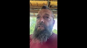 The Slingshot Socket™ improves stability and ambulation confidence so much that others notice improved gait. Check out Scott’s feedback from his family on how much better he’s now walking with the Slingshot Socket™. #prosthetics #amputee #slingshotsocket #slingshotbionics #adjustablesocket | Slingshot Bionics