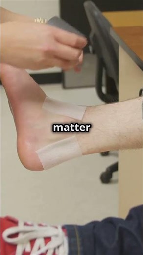 Swollen Legs? Here’s the Real Deal on Elevation! #shorts