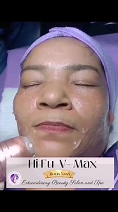 11 reactions · 3 comments | ✨HI fu V MAX Treatment ✨‼️ **Benefits......