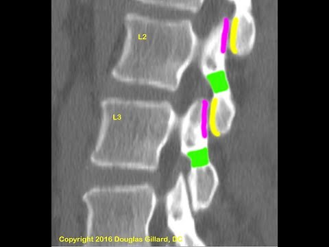 Spinal Anatomy: The Lumbar Spine--An Advanced Lecture