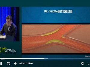 mouserecorder怎么使用