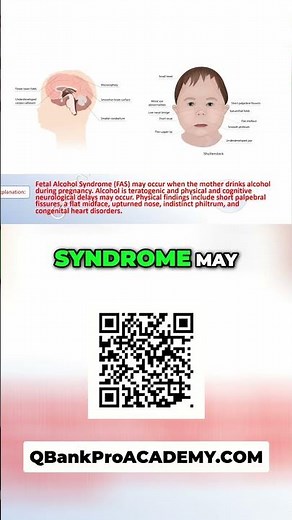 Fetal Alcohol Syndrome: Key Physical Findings Explained