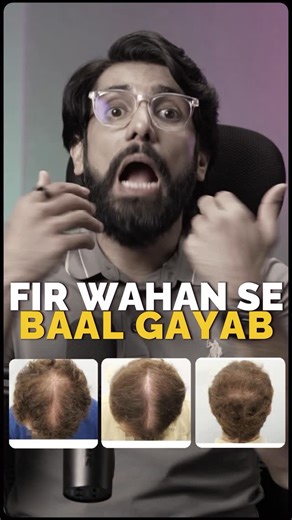 Mihir Gadani on Instagram: "Hair falling out in clumps after a stressful phase? 😟 It’s not in your head — it’s in your biology. Mihir Gadani (OZiva Co-Founder) explains how stress shocks your hair cycle, pushes follicles into the “shedding phase,” and leads to sudden, massive hair fall weeks later. 🎥 Watch the full breakdown on our YouTube channel. #hairfall #dhtblocker #thinninghairsolutions #hairlossawareness #haircaretips #scalphealth #stophairfall #hairthinningsolution #hairproblemsolution