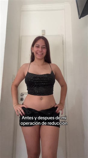 La mejor decisión de mi vida hacerme la reducción #paratii #fyp #reduccionmamamaria