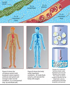 Hyperbaric Oxygen Therapy - O2 WNY