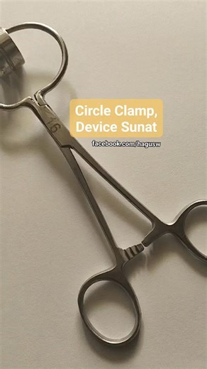 Hagus on Instagram: "Circle Clamp sunat adalah alat bantu modern berbentuk cincin atau penjepit yang digunakan dalam prosedur khitan (sunat) Fungsinya untuk menjepit kulup, memungkinkan pemotongan yang cepat, minim rasa sakit, minim perdarahan, dan tanpa jahitan, menghasilkan hasil yang lebih rapi dan pemulihan lebih cepat, aman untuk anak-anak maupun dewasa, serta tersedia dalam berbagai ukuran untuk berbagai kebutuhan. Alat ini merupakan inovasi dari metode sunat klamp tradisional, dengan keun