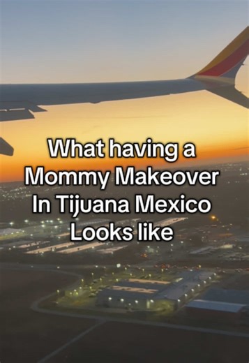 Drop any questions you have about getting a mommy makeover in Tijuana Mexico! @Dr. Illich Navarro #mommymakeoverjourney #tijuana #armlift #tummytuck