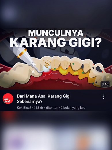 Pahami Karang Gigi dan Penyebabnya