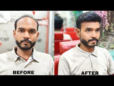 Hair wig hair patch Shop in Agra mathura mo.7037489714, Hair patch service near me mathura, bhartpur