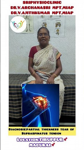 Partial tear of Supraspinatus tendon❌ #physiotherapist #shoulderpain #shoulderpainrelief