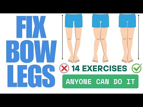 14 Exercises to Fix Bow Legs | Anyone can do it at any age.