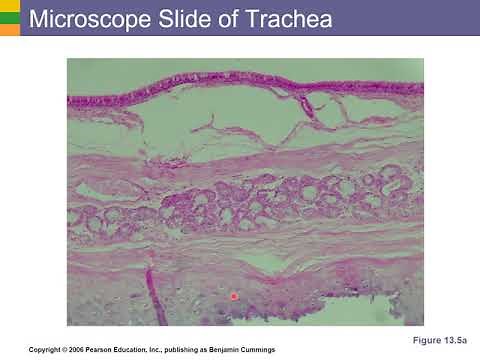 Microscope Slide of Trachea