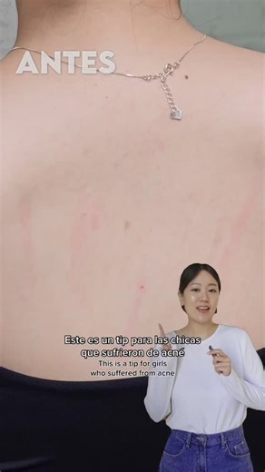 Tati | 따띠 on Instagram: "Es publicidad pero saben que me encanta recomendarles productos que me ayudaron a mejorar la piel. Y estoy segura que estos 2 productos les van a encantar! 👌 El tip de hoy es para las personas que sufren de acné en la espalda y/o pecho, especialmente ahora que se viene el verano en Latam y es temporada de las musculosas y bikinis. La clave para reducir el backne y chestne es: exfoliación e hidratación. Ya les recomendé el 'Cicamanu pH Balanced Body Mist' de @parnell_glo