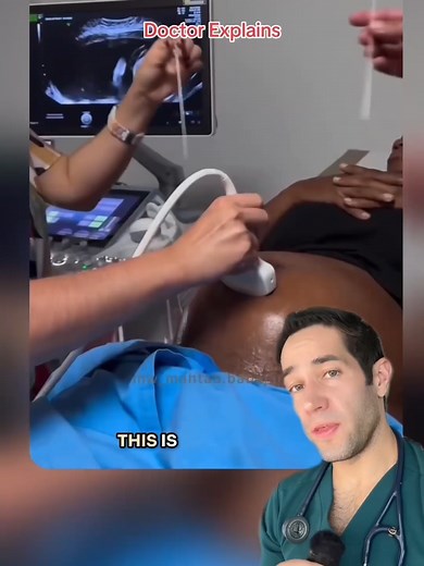 Have you heard of this before? (VC: mw.mahtab.babajani on IG) #ultrasound #doctorexplains #amniocentesis #medical