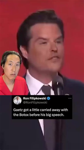 Learn from Matt Gaetz’s Botox journey! 😉 #celebrity #eyebrows #doctorreacts | Dr. Anthony Youn