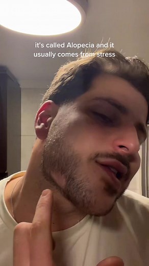 Since you all keep asking me about it #foryou#fyp#foryoupage#yourboidanyyyy