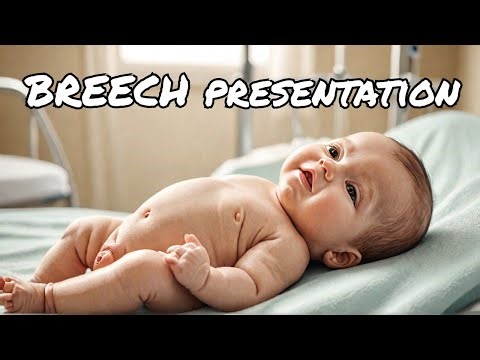 62. Breech Presentation👶 Obstetrics & Gynecology for USMLE Step 2 CK | Types, Diagnosis & Management