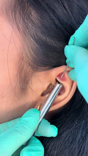 Ultimate Guide to Rook Piercing: Benefits & Aftercare