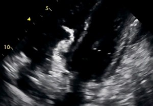 Positive Bubble Study (example)